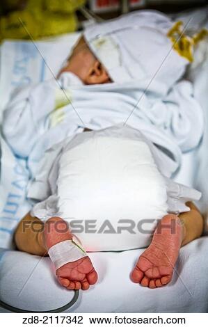 Stock Image - Premature in ICU.. Fotosearch