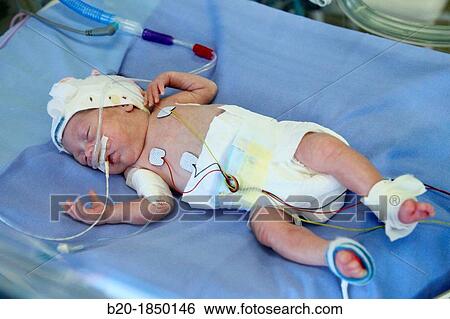 Premature, Neonate Intensive care Unit, Donostia Hospital, San Sebastian, Donostia, Gipuzkoa, Basque Country, Spain View Large Photo Image Stock Photograph - Premature, Neonate Intensive care Unit, Donostia Hospital, San Sebastian, Donostia, Gipuzkoa, Basque Country, Spain. Fotosearch