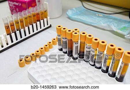 Preparation of blood samples, DNA and RNA biobank, extraction and storage of DNA/RNA from blood samples, Biodonostia Health and Biomedicine Research Institute, San Sebastian, Donostia, Gipuzkoa, Euskadi, Spain View Large Photo Image Stock Image - Preparation of blood samples, DNA and RNA biobank, extraction and storage of DNA/RNA from blood samples, Biodonostia Health and Biomedicine Research Institute, San Sebastian, Donostia, Gipuzkoa, Euskadi, Spain. Fotosearch