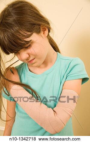 Stock Photo - Preteen girl with a bandaged arm. Fotosearch