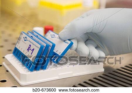 Prionics-Check PrioSTRIP test for detection and isolation of the prion protein, Laboratory of Bacteriology, Departamento de Producci? n y Sanidad Animal, Neiker Tecnalia, Derio, Bizkaia, Euskadi, Spain View Large Photo Image Stock Image - Prionics-Check PrioSTRIP test for detection and isolation of the prion protein, Laboratory of Bacteriology, Departamento de Producci? n y Sanidad Animal, Neiker Tecnalia, Derio, Bizkaia, Euskadi, Spain. Fotosearch