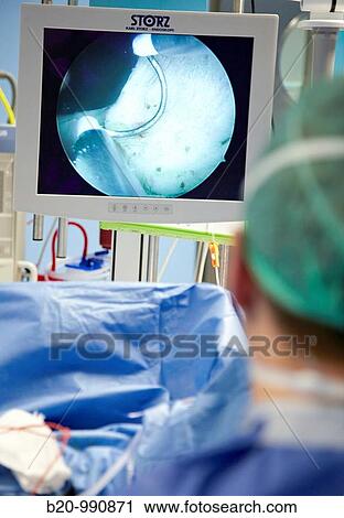 Prostate surgery, bipolar TURP (transurethral resection of the prostate), urology. Hospital Policlinica Gipuzkoa, San Sebastian, Donostia, Euskadi, Spain View Large Photo Image Stock Image - Prostate surgery, bipolar TURP (transurethral resection of the prostate), urology. Hospital Policlinica Gipuzkoa, San Sebastian, Donostia, Euskadi, Spain. Fotosearch