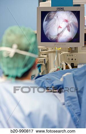Prostate surgery, bipolar TURP (transurethral resection of the prostate), urology. Hospital Policlinica Gipuzkoa, San Sebastian, Donostia, Euskadi, Spain View Large Photo Image Stock Photo - Prostate surgery, bipolar TURP (transurethral resection of the prostate), urology. Hospital Policlinica Gipuzkoa, San Sebastian, Donostia, Euskadi, Spain. Fotosearch