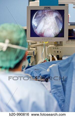 Stock Photograph - Prostate surgery, bipolar TURP (transurethral resection of the prostate), urology. Hospital Policlinica Gipuzkoa, San Sebastian, Donostia, Euskadi, Spain. Fotosearch