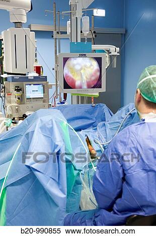Prostate surgery using a green laser, urology. Hospital Policlinica Gipuzkoa, San Sebastian, Donostia, Euskadi, Spain View Large Photo Image Stock Photography - Prostate surgery using a green laser, urology. Hospital Policlinica Gipuzkoa, San Sebastian, Donostia, Euskadi, Spain. Fotosearch