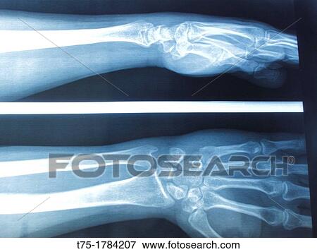 Stock Photo - Radiography. Fotosearch