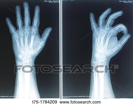 Stock Photo - Radiography. Fotosearch