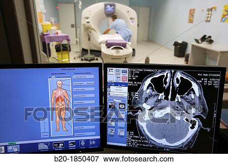 Radiology Interpretation Screen, CAT, Computarized Axial Tomography, Radiology Department, Donostia Hospital, San Sebastian, Donostia, Gipuzkoa, Basque Country, Spain View Large Photo Image Stock Photo - Radiology Interpretation Screen, CAT, Computarized Axial Tomography, Radiology Department, Donostia Hospital, San Sebastian, Donostia, Gipuzkoa, Basque Country, Spain. Fotosearch
