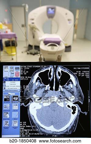 Radiology Interpretation Screen, CAT, Computarized Axial Tomography, Radiology Department, Donostia Hospital, San Sebastian, Donostia, Gipuzkoa, Basque Country, Spain View Large Photo Image Stock Photo - Radiology Interpretation Screen, CAT, Computarized Axial Tomography, Radiology Department, Donostia Hospital, San Sebastian, Donostia, Gipuzkoa, Basque Country, Spain. Fotosearch