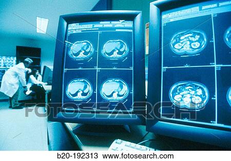 Radiology View Large Photo Image Stock Image - Radiology. Fotosearch