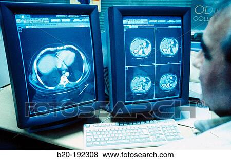 Radiology View Large Photo Image Stock Photo - Radiology. Fotosearch