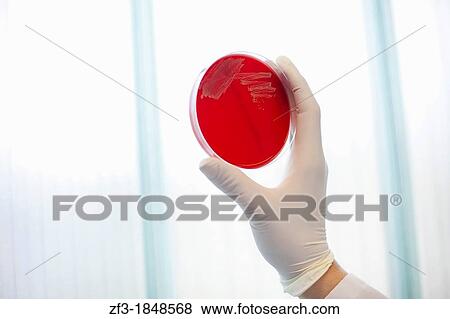 Red Cultivation tray on scientist hand View Large Photo Image Stock Photo - Red Cultivation tray on scientist hand. Fotosearch
