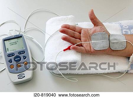 Stock Image - Rehabilitation, application of electrical current through the skin for pain control. Hospital Universitario de Gran Canaria Doctor Negrin, Las Palmas de Gran Canaria. Canary Islands, Spain. Fotosearch
