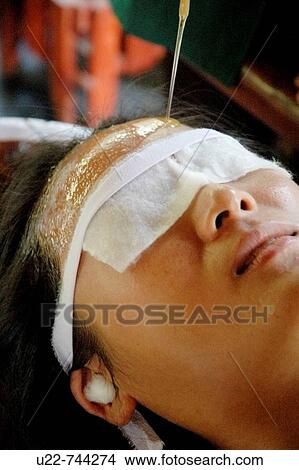 Saligao Goa, India, a woman receiving a massage with oil at the Ayurvedic Natural Health Centre View Large Photo Image Picture - Saligao Goa, India, a woman receiving a massage with oil at the Ayurvedic Natural Health Centre. Fotosearch