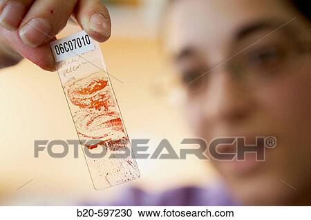 Stock Image - Sample, Pathological anatomy. Hospital de Zumarraga, Gipuzkoa, Euskadi, Spain. Fotosearch
