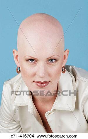 Sexy bald caucassian woman with alopecia View Large Photo Image Picture - Sexy bald caucassian woman with alopecia. Fotosearch