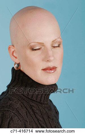 Sexy bald woman with alopecia View Large Photo Image Picture - Sexy bald woman with alopecia. Fotosearch