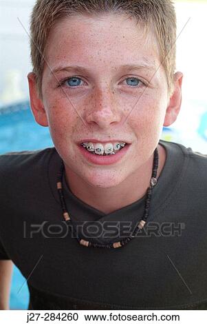 Smiling boy with dental braces View Large Photo Image Stock Image - Smiling boy with dental braces. Fotosearch