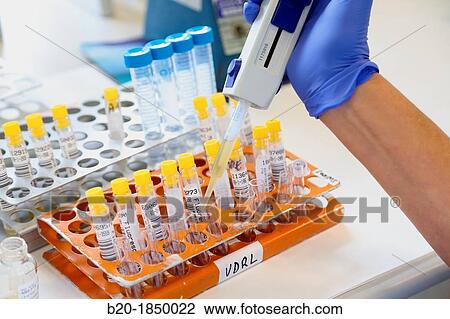 Specimens, Microfluorescence, Microbiology Department, Donostia Hospital, San Sebastian, Donostia, Gipuzkoa, Basque Country, Spain View Large Photo Image Stock Image - Specimens, Microfluorescence, Microbiology Department, Donostia Hospital, San Sebastian, Donostia, Gipuzkoa, Basque Country, Spain. Fotosearch
