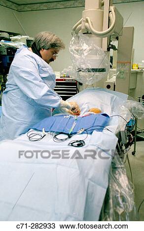 stent insertion View Large Photo Image Stock Image - stent insertion. Fotosearch