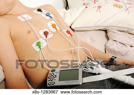 Stock Photo - Stock photo of an 11 year old boy wearing a Holter heart monitor. Fotosearch