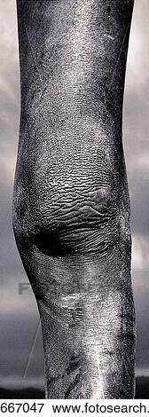 Stock Photo - Surma boy's knee. South Ethiopia. Fotosearch