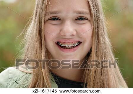 Teenager girl with dental braces View Large Photo Image Stock Photography - Teenager girl with dental braces. Fotosearch