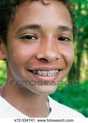 Teenager With Braces View Large Photo Image Stock Image - Teenager With Braces. Fotosearch