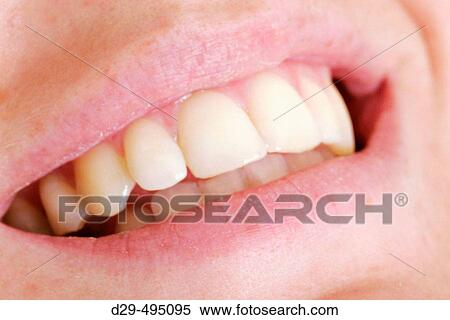 Teeth. View Large Photo Image Stock Photography - Teeth.. Fotosearch