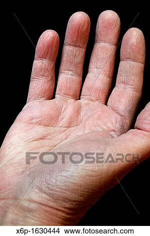 Picture - The dryed cracked hand of an older man reaching out. Fotosearch