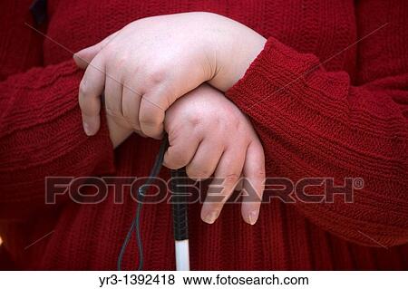 The hands of a blind female student hold her cane View Large Photo Image Stock Photo - The hands of a blind female student hold her cane. Fotosearch