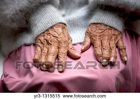 Stock Photography - The hands of an elderly woman in the Our Lady of Guadalupe Home for the Elderly, Mexico City, December 13, 2010. Fotosearch