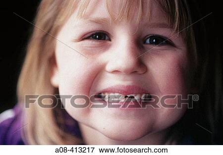 The toothless smile of a seven year old girl. Pennsylvania. USA. View Large Photo Image Stock Photo - The toothless smile of a seven year old girl. Pennsylvania. USA.. Fotosearch