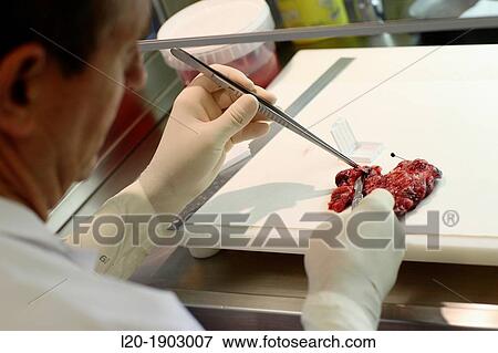 Stock Photo - tissue sample selection Thyroid, Anatomic Pathology, Onkologikoa Hospital, Oncology Institute, Case Center for prevention, diagnosis and treatment of cancer, Donostia, San Sebastian, Gipuzkoa, Basque Country, Spain. Fotosearch