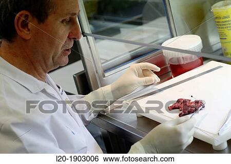 tissue sample selection Thyroid, Anatomic Pathology, Onkologikoa Hospital, Oncology Institute, Case Center for prevention, diagnosis and treatment of cancer, Donostia, San Sebastian, Gipuzkoa, Basque Country, Spain View Large Photo Image Stock Photograph - tissue sample selection Thyroid, Anatomic Pathology, Onkologikoa Hospital, Oncology Institute, Case Center for prevention, diagnosis and treatment of cancer, Donostia, San Sebastian, Gipuzkoa, Basque Country, Spain. Fotosearch