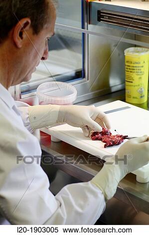 tissue sample selection Thyroid, Anatomic Pathology, Onkologikoa Hospital, Oncology Institute, Case Center for prevention, diagnosis and treatment of cancer, Donostia, San Sebastian, Gipuzkoa, Basque Country, Spain View Large Photo Image Stock Photography - tissue sample selection Thyroid, Anatomic Pathology, Onkologikoa Hospital, Oncology Institute, Case Center for prevention, diagnosis and treatment of cancer, Donostia, San Sebastian, Gipuzkoa, Basque Country, Spain. Fotosearch