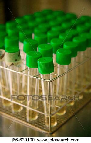 Stock Image - University, Spanish collection of average. Microbiology lab. Cold depot.. Fotosearch