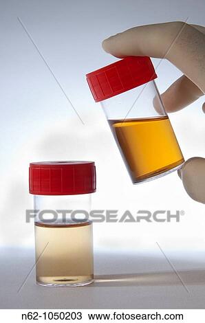 Urine in tube prepared for testing View Large Photo Image Stock Image - Urine in tube prepared for testing. Fotosearch