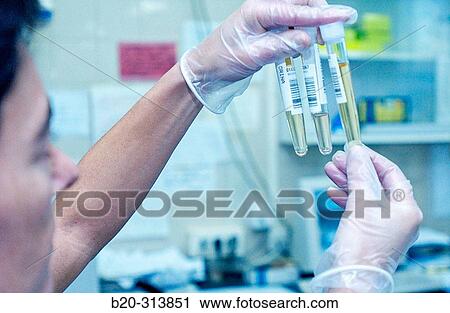 Urine samples to analyze at laboratory of hospital View Large Photo Image Stock Image - Urine samples to analyze at laboratory of hospital. Fotosearch