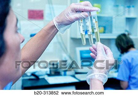 Urine samples to analyze at laboratory of hospital View Large Photo Image Stock Image - Urine samples to analyze at laboratory of hospital. Fotosearch