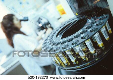 Urine test View Large Photo Image Stock Image - Urine test. Fotosearch