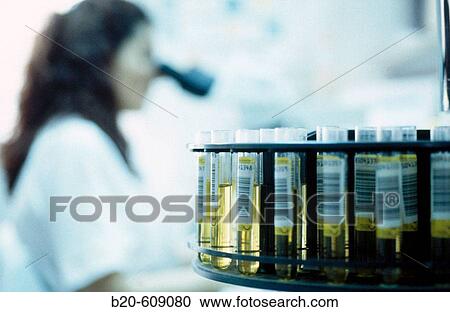 Urine test View Large Photo Image Stock Image - Urine test. Fotosearch