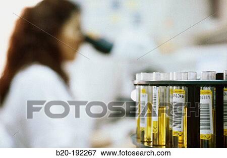 Urine test View Large Photo Image Stock Photo - Urine test. Fotosearch