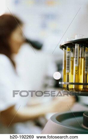 Stock Photo - Urine test. Fotosearch