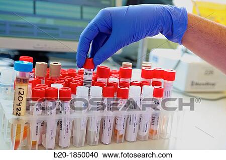 Virus Celular Cultures, Microbiology Department, Donostia Hospital, San Sebastian, Donostia, Gipuzkoa, Basque Country, Spain View Large Photo Image Stock Image - Virus Celular Cultures, Microbiology Department, Donostia Hospital, San Sebastian, Donostia, Gipuzkoa, Basque Country, Spain. Fotosearch