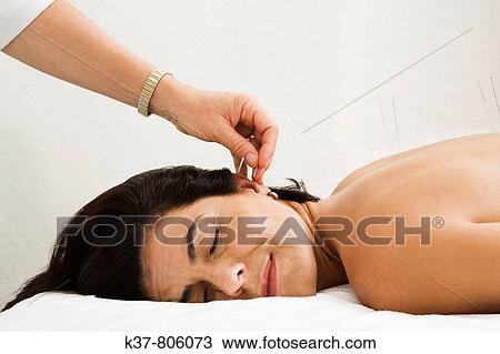 Woman having acupuncture therapy View Large Photo Image Stock Image - Woman having acupuncture therapy. Fotosearch