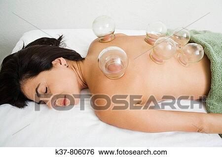 Stock Photograph - Woman having cupping therapy. Fotosearch