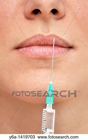 Woman receiving injection in lip close-up View Large Photo Image Stock Image - Woman receiving injection in lip close-up. Fotosearch