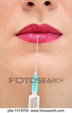 Woman receiving injection in lip close-up View Large Photo Image Stock Photography - Woman receiving injection in lip close-up. Fotosearch