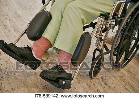 Woman with swollen legs in wheelchair View Large Photo Image Stock Image - Woman with swollen legs in wheelchair. Fotosearch